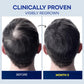 ProBliva Minoxidil Hair Growth Treatment for Men