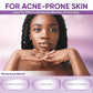 AOBBIY Azelaic Acid Acne Cream