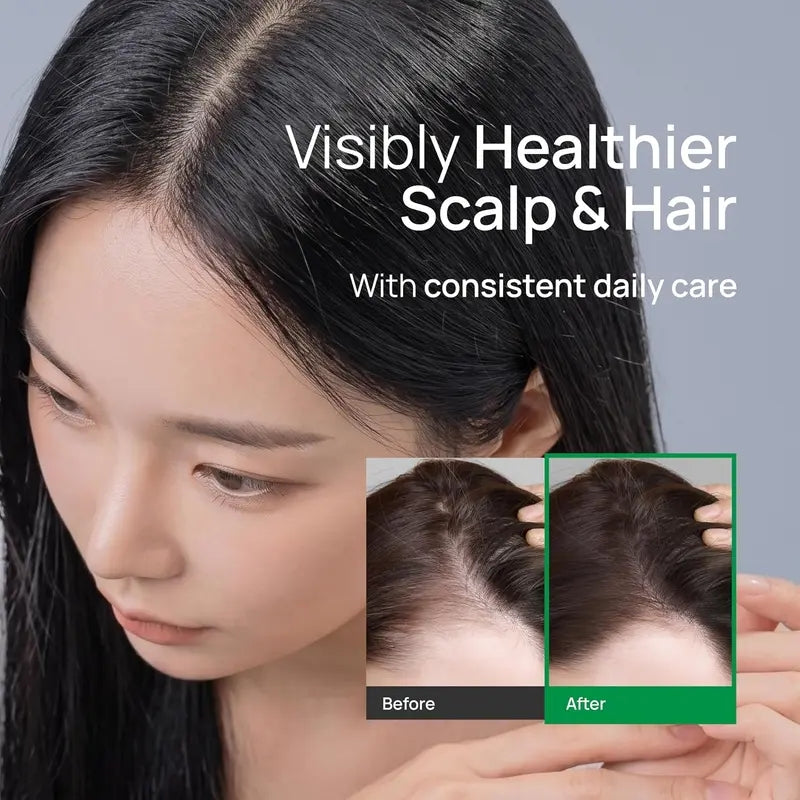 TEREZ & HONOR Scalp Strengthening Hair Serum – Korean Cooling Roll-On with Caffeine, Niacinamide & Panthenol