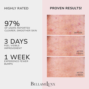 BellamiLuxx Butt Acne Clearing Treatment Cream