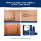 Murasaki Beauty Advanced Silicone Scar Stick