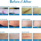 Aroamas Silicone Scar Sheets