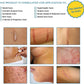 Aroamas Silicone Scar Sheets