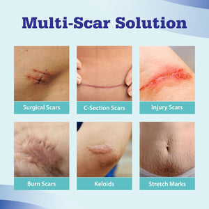 Aroamas Advanced Scar Gel