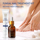 Natural Vine Fungal Nail Treatment Kit