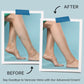 Hermon Varicose Veins Cream