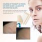 Aroamas Silicone Scar Sheets