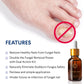 Natural Vine Fungal Nail Treatment Kit