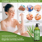 Roycederm Tea Tree Body Wash, Anti-bacterial & Anti-fungal, 16.9 fl oz