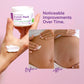 Vigority Stretch Mark Cream