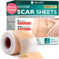 AirroYE Silicone Scar Sheets, Silicone Scar Tape (1.6"x 120" Roll-3M)